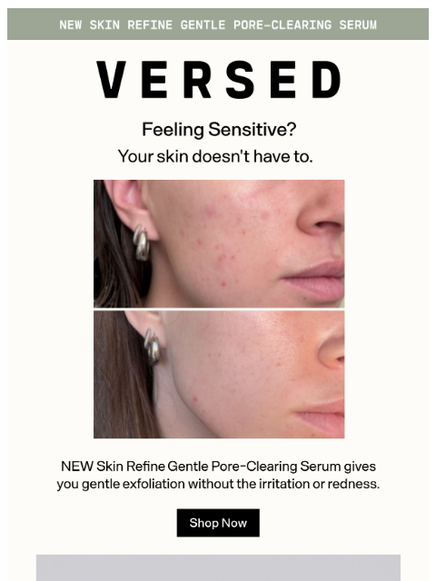 versedskin newsletter: Fall in Love with a Gentler Exfoliant