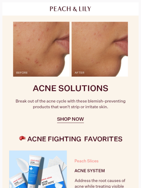 Say goodbye to acne. ͏ ͏ ͏ ͏ ͏ ͏ ͏ ͏ ͏ ͏ ͏ ͏ ͏ ͏ ͏ ͏ ͏ ͏ ͏ ͏ ͏ ͏ ͏ ͏ ͏ ͏ ͏ ͏ ͏ ͏ ͏ ͏ ͏ ͏ ͏ ͏ ͏ ͏ ͏ ͏ ͏ ͏ ͏ ͏ ͏ ͏ ͏ ͏ ͏ ͏ ͏ ͏ ͏ ͏ ͏ ͏ ͏ ͏ ͏ ͏ ͏ ͏ ͏ ͏ ͏ ͏ ͏ ͏ ͏ ͏ ͏ ͏ ͏ ͏ ͏ ͏ ͏ ͏ ͏ ͏ ͏ ͏ ͏ ͏ ͏ ͏ ͏ ͏ ͏ ͏