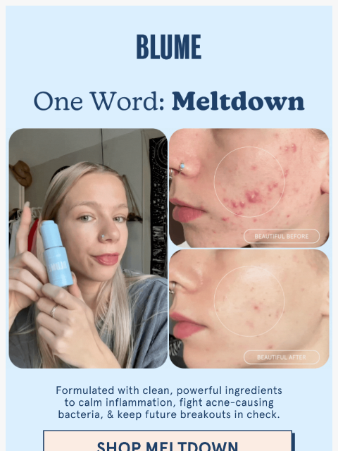 One product, clearer skin ͏ ͏ ͏ ͏ ͏ ͏ ͏ ͏ ͏ ͏ ͏ ͏ ͏ ͏ ͏ ͏ ͏ ͏ ͏ ͏ ͏ ͏ ͏ ͏ ͏ ͏ ͏ ͏ ͏ ͏ ͏ ͏ ͏ ͏ ͏ ͏ ͏ ͏ ͏ ͏ ͏ ͏ ͏ ͏ ͏ ͏ ͏ ͏ ͏ ͏ ͏ ͏ ͏ ͏ ͏ ͏ ͏ ͏ ͏ ͏ ͏ ͏ ͏ ͏ ͏ ͏ ͏ ͏ ͏ ͏ ͏ ͏ ͏ ͏ ͏ ͏ ͏ ͏ ͏ ͏ ͏ ͏ ͏ ͏ ͏ ͏ ͏ ͏