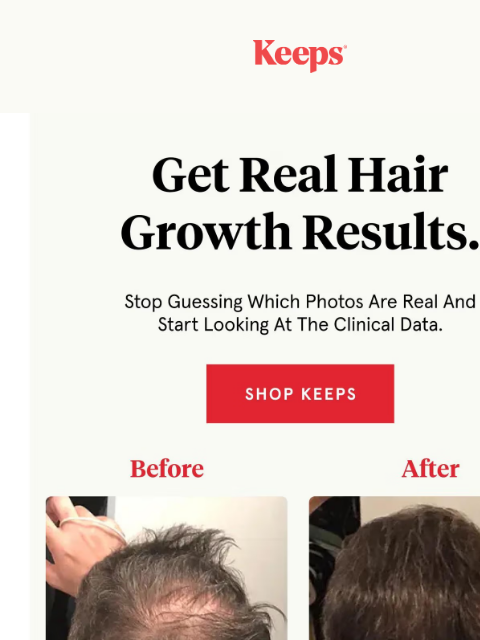 keeps newsletter: The Hair Results Backed By A Million Men
