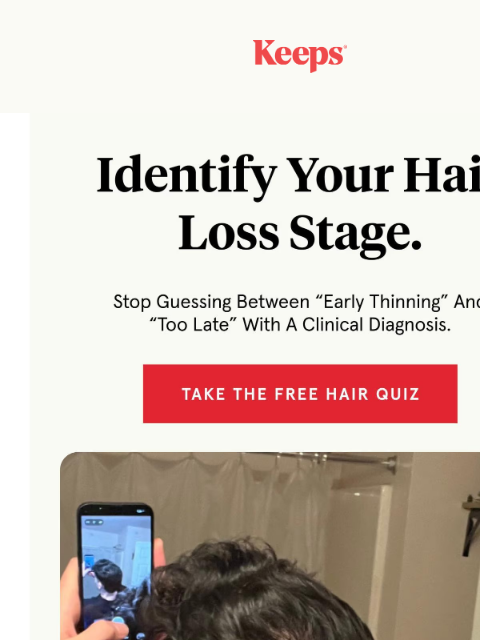 keeps newsletter: What Stage Of Hair Loss Are You Actually At?