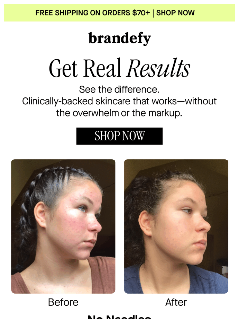 brandefyskin newsletter: Get real results