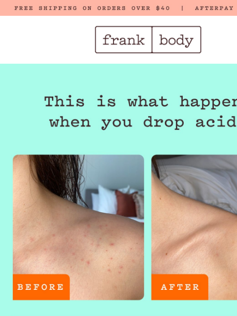 frankbody newsletter: Acid receipts: The proof it works.